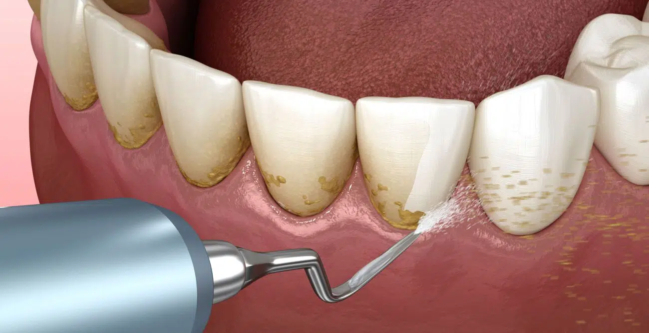 Stomatologie Generală la Clinica Dr. Corlade din Bacău
